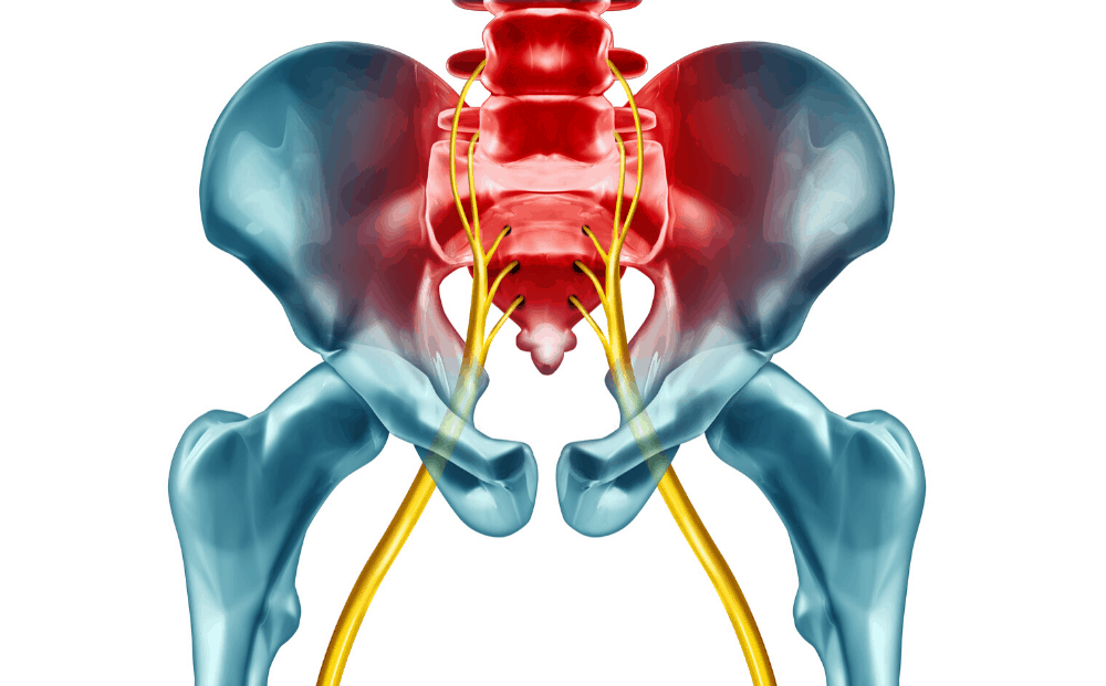 A DEFINITIVE GUIDE FOR THE SCIATICA TREATMENT BY GUEST BLOGGER DANIEL CLARK